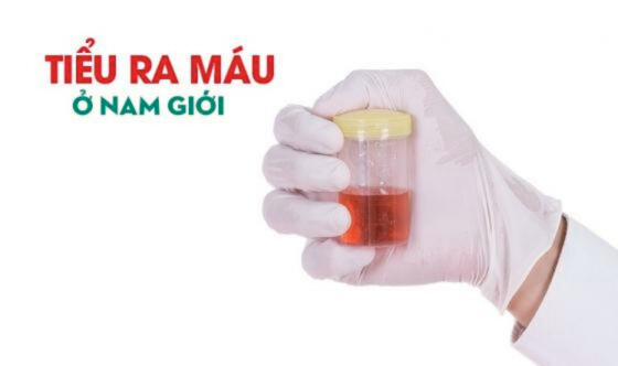 Thiết kế chưa có tên (72).png