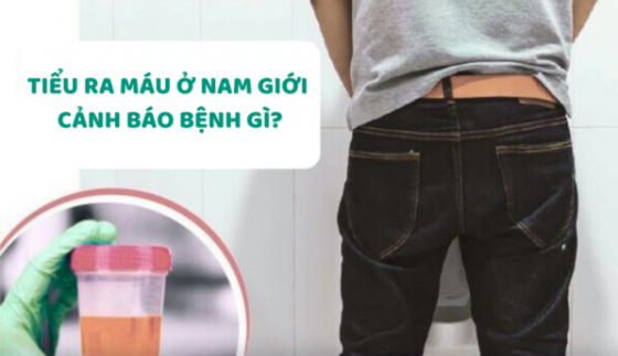 Thiết kế chưa có tên (73).png