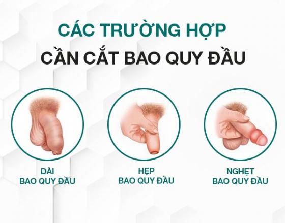 cat-bao-quy-dau-1.jpg