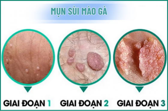 1759483232533134.png chua-benh-hieu-qua (34).png