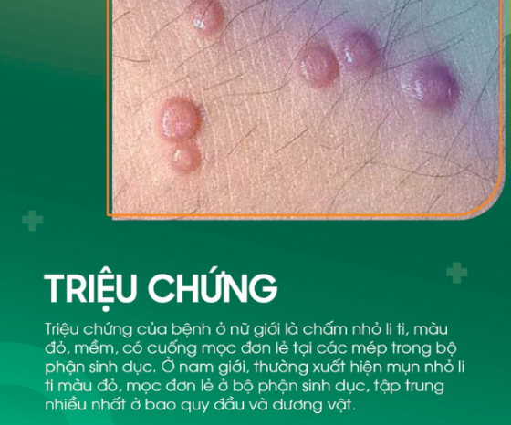 pk-binh-duong (7).png