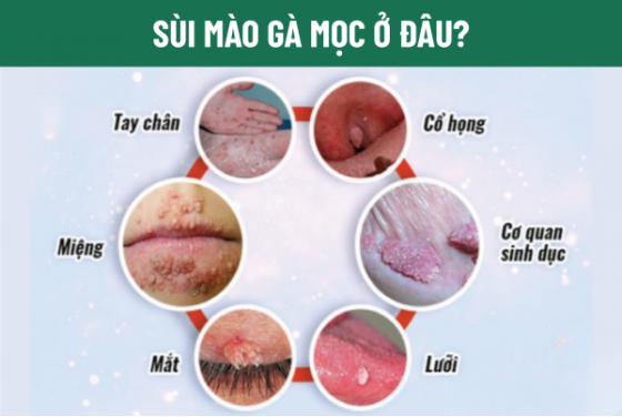 1759566981653062.png chua-benh-hieu-qua (48).png