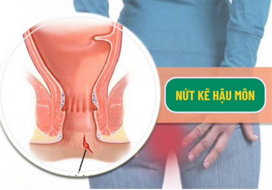 chua-benh-hieu-qua (60).png