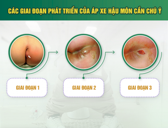 pk-binh-duong (11).png