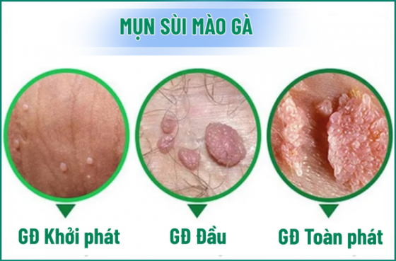 1761117379631819.png chua-benh-hieu-qua (85).png