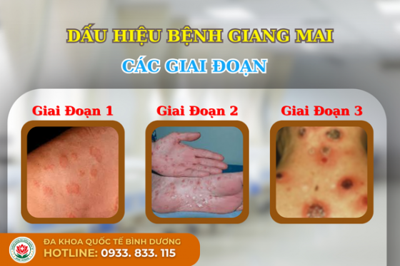 1761384973220963.png Trĩ (11).png