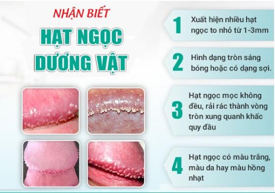 hat-ngoc-dv.jpg