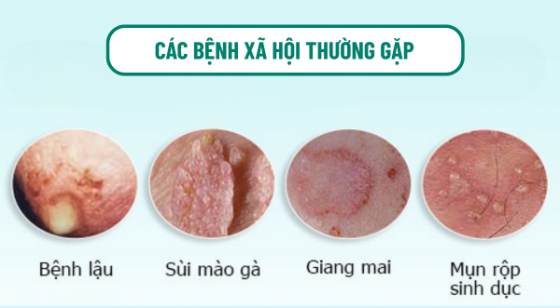 chua-benh-hieu-qua (95).png