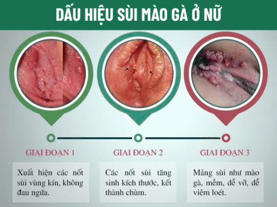 pk-binh-duong (9).png