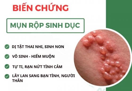 1761643400951002.jpg mun-rop-bien-chung.jpg