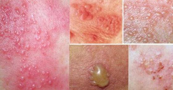 1761643520853198.jpg mun-rop-2.jpg