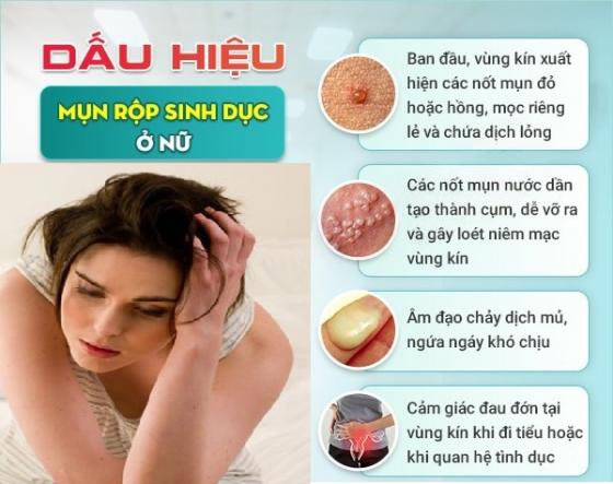 1761643759125673.jpg mun-rop-o-nu-gioi.jpg