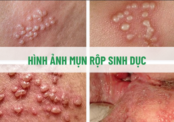 chua-benh-hieu-qua (64).png