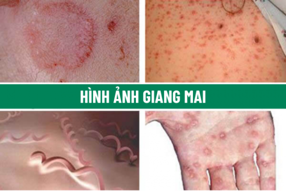 chua-benh-hieu-qua (87).png