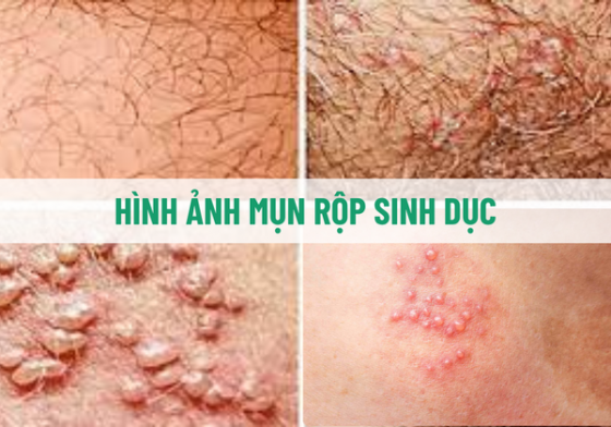 chua-benh-hieu-qua - 2025-10-29T103936.507.png