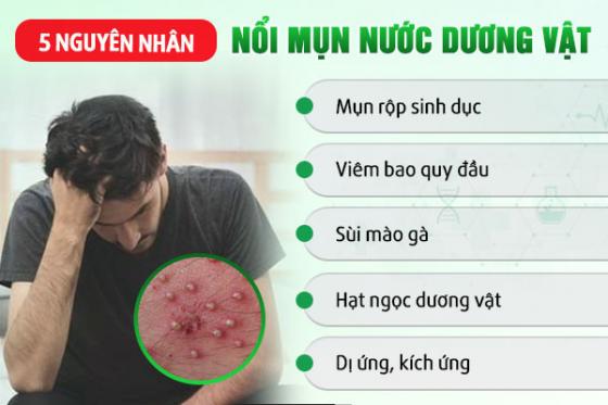mun-nuoc.jpg